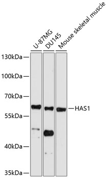 Western blot - HAS1 Polyclonal Antibody 