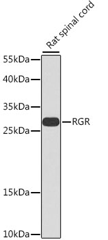 Western blot - RGR Polyclonal Antibody 