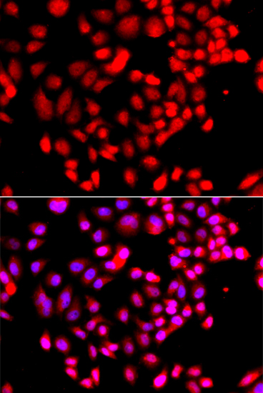 Immunofluorescence - RPS6KL1 Polyclonal Antibody 