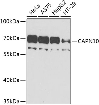 Western blot - CAPN10 Polyclonal Antibody 