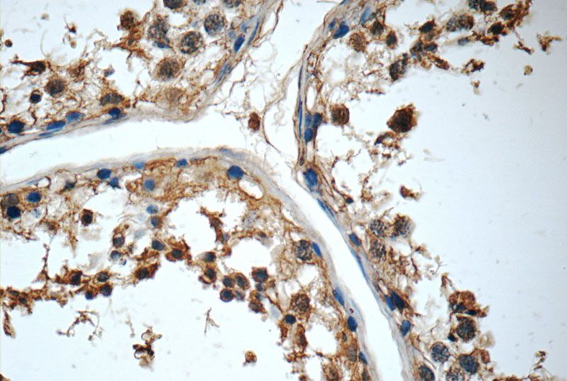 Immunohistochemistry of paraffin-embedded human testis tissue slide using Catalog No:112825(MRPL36 Antibody) at dilution of 1:50 (under 40x lens)