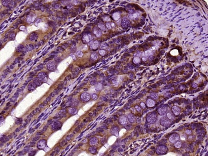 Fig1: Paraformaldehyde-fixed, paraffin embedded (rat intestine tissue); Antigen retrieval by boiling in sodium citrate buffer (pH6.0) for 15min; Block endogenous peroxidase by 3% hydrogen peroxide for 20 minutes; Blocking buffer (normal goat serum) at 37℃ for 30min; Antibody incubation with (PATL2) Polyclonal Antibody, Unconjugated at 1:400 overnight at 4℃, followed by operating according to SP Kit(Rabbit) (sp-0023) instructionsand DAB staining.