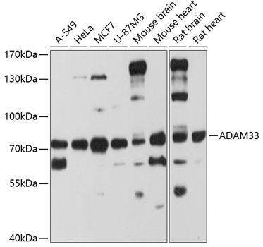 Western blot - ADAM33 Polyclonal Antibody 