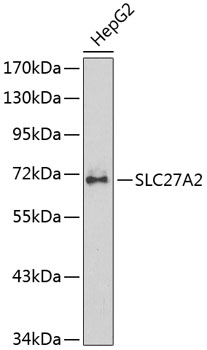 Western blot - SLC27A2 Polyclonal Antibody 