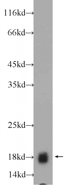 HEK-293 cells were subjected to SDS PAGE followed by western blot with Catalog No:108399(BAALC Antibody) at dilution of 1:600