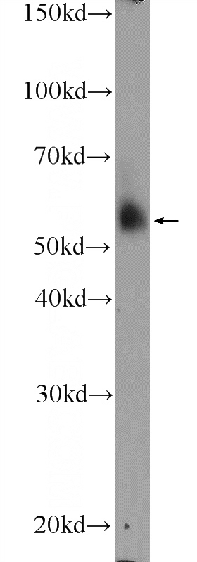 human placenta tissue were subjected to SDS PAGE followed by western blot with Catalog No:108034(APOL4 Antibody) at dilution of 1:2000