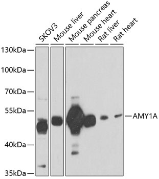 Western blot - AMY1A Polyclonal Antibody 