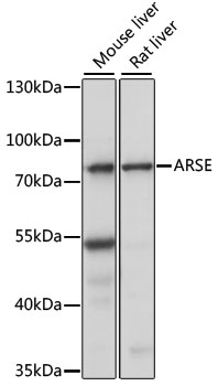 Western blot - ARSE Polyclonal Antibody 