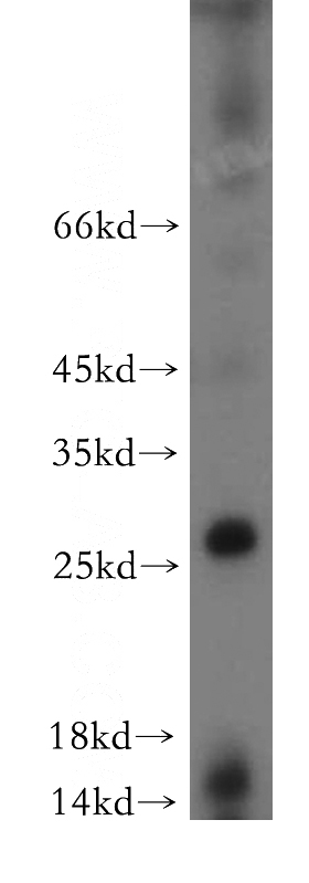 mouse spleen tissue were subjected to SDS PAGE followed by western blot with Catalog No:108681(C1orf77 antibody) at dilution of 1:500