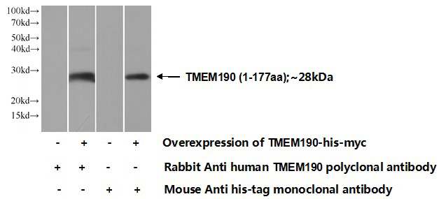 Transfected HEK-293 cells were subjected to SDS PAGE followed by western blot with Catalog No:116111(TMEM190 Antibody) at dilution of 1:700