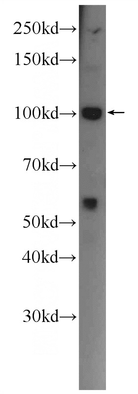 MCF-7 cells were subjected to SDS PAGE followed by western blot with Catalog No:117048(ZFYVE28 Antibody) at dilution of 1:300