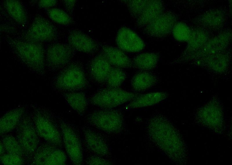 Immunofluorescent analysis of (10% Formaldehyde) fixed HeLa cells using Catalog No:112029(KDM5C Antibody) at dilution of 1:50 and Alexa Fluor 488-congugated AffiniPure Goat Anti-Rabbit IgG(H+L)