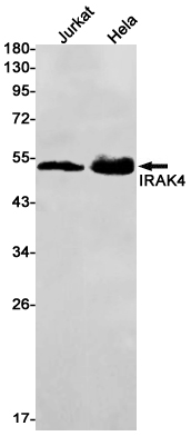 Western blot detection of IRAK4 in Jurkat,Hela cell lysates using IRAK4 Rabbit mAb(1:1000 diluted).Predicted band size:52kDa.Observed band size:52kDa.