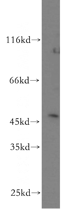 mouse brain tissue were subjected to SDS PAGE followed by western blot with Catalog No:108608(C16orf70 antibody) at dilution of 1:500