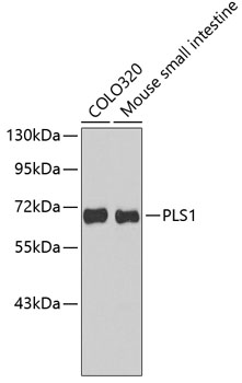 Western blot - PLS1 Polyclonal Antibody 