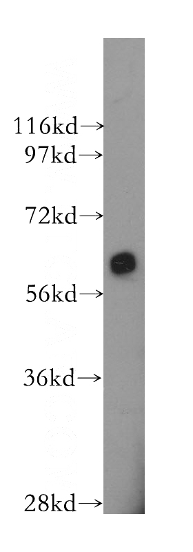 HeLa cells were subjected to SDS PAGE followed by western blot with Catalog No:108006(PRKAA1 antibody) at dilution of 1:300