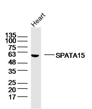 Fig2: Sample: Heart (Mouse) Lysate at 40 ug; Primary: Anti-SPATA15/SPATC1 at 1/300 dilution; Secondary: IRDye800CW Goat Anti-Rabbit IgG at 1/20000 dilution; Predicted band size: 62kD; Observed band size: 62kD