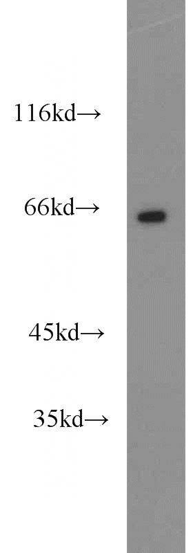 human heart tissue were subjected to SDS PAGE followed by western blot with Catalog No:112285(LMOD3 antibody) at dilution of 1:1500
