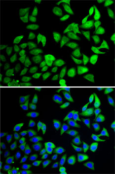 Immunofluorescence - USP8 Polyclonal Antibody 