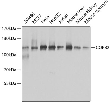 Western blot - COPB2 Polyclonal Antibody 
