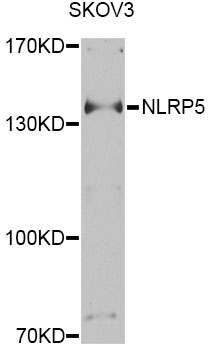 Western blot - NLRP5 Polyclonal Antibody 