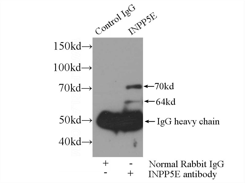 IP Result of anti-INPP5E (IP:Catalog No:111844, 3ug; Detection:Catalog No:111844 1:1000) with HEK-293 cells lysate 1000ug.