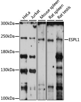 Western blot - ESPL1 Polyclonal Antibody 
