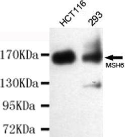 Western blot detection of MSH6 in 293 and HCT116 cell lysates using MSH6 mouse mAb (1:300-1:500 diluted).Predicted band size:160KDa.Observed band size:160KDa.