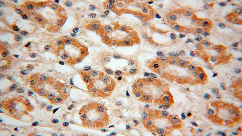 Immunohistochemical of paraffin-embedded human kidney using Catalog No:107718(ACADL antibody) at dilution of 1:50 (under 40x lens)