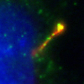 IF result of Catalog No:114460 (anti-RAB8A,Green) in ciliated IMCD3 cells by Dr. Seongjin Seo. (Red is the primary cilium, and blue is the nucleus) The stain of this antibody is weaker.