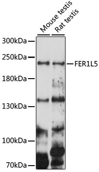 Western blot - FER1L5 Polyclonal Antibody 