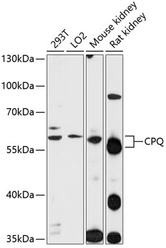 Western blot - CPQ Polyclonal Antibody 