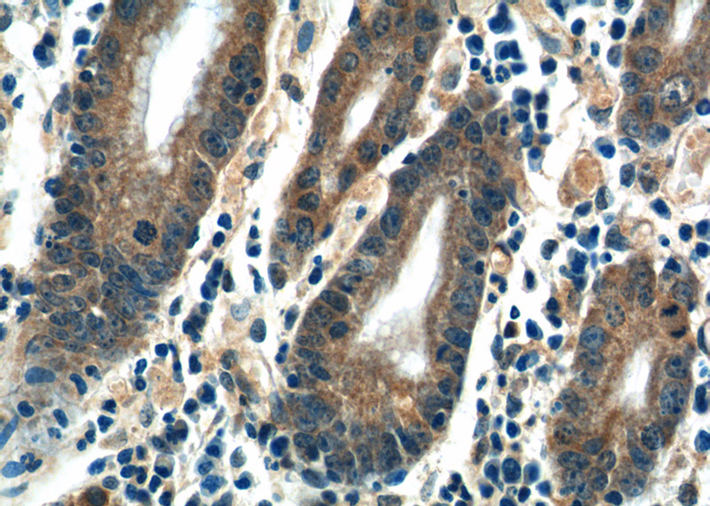 Immunohistochemistry of paraffin-embedded human stomach tissue slide using Catalog No:109413(CMC1 Antibody) at dilution of 1:50 (under 40x lens)