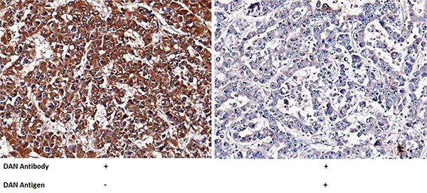 NBL1 / DAND1 / DAN Antibody, Mouse MAb, Immunohistochemistry
