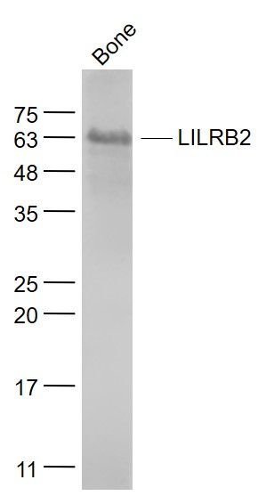 Fig2: Sample:; Bone (Mouse) Lysate at 40 ug; Primary: Anti- LILRB2 at 1/1000 dilution; Secondary: IRDye800CW Goat Anti-Rabbit IgG at 1/20000 dilution; Predicted band size: 65 kD; Observed band size: 65kD