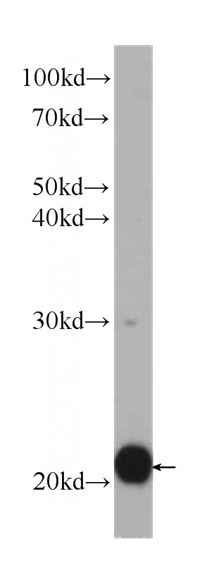 Jurkat cells were subjected to SDS PAGE followed by western blot with Catalog No:107018(BID Antibody) at dilution of 1:1000