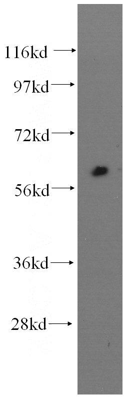 human kidney tissue were subjected to SDS PAGE followed by western blot with Catalog No:107213(FMOD antibody) at dilution of 1:250