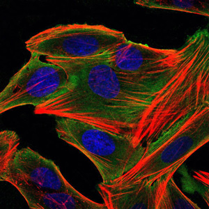 Immunofluorescence analysis of HepG2 cells using RSK2 mouse mAb (green). Blue: DRAQ5 fluorescent DNA dye. Red: Actin filaments have been labeled with Alexa Fluor-555 phalloidin.