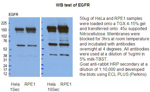 WB result ofanti-EGFR in Hela and REP1 cell by Dr.Kodani, Andrew.