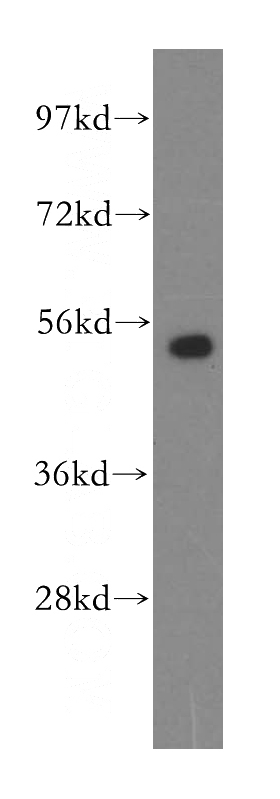 MCF7 cells were subjected to SDS PAGE followed by western blot with Catalog No:114028(PMPCB antibody) at dilution of 1:500