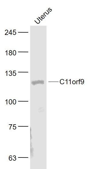 Fig3: Sample:; Uterus (Mouse) Lysate at 40 ug; Primary: Anti- MRF/C11orf9 at 1/1000 dilution; Secondary: IRDye800CW Goat Anti-Rabbit IgG at 1/20000 dilution; Predicted band size: 124 kD; Observed band size: 124 kD