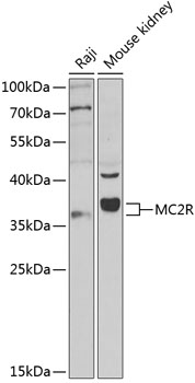 Western blot - MC2R Polyclonal Antibody 