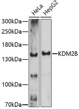 Western blot - KDM2B Polyclonal Antibody 