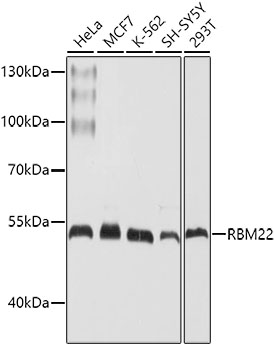 Western blot - RBM22 Polyclonal Antibody 