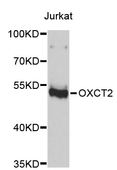 Western blot - OXCT2 Polyclonal Antibody 