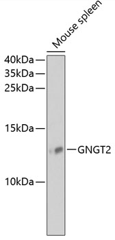 Western blot - GNGT2 Polyclonal Antibody 