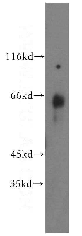 human brain tissue were subjected to SDS PAGE followed by western blot with Catalog No:110934(GEFT antibody) at dilution of 1:300