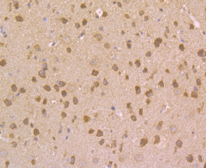 Fig6: Immunohistochemical analysis of paraffin-embedded mouse brain tissue using anti-NRCAM antibody. Counter stained with hematoxylin.