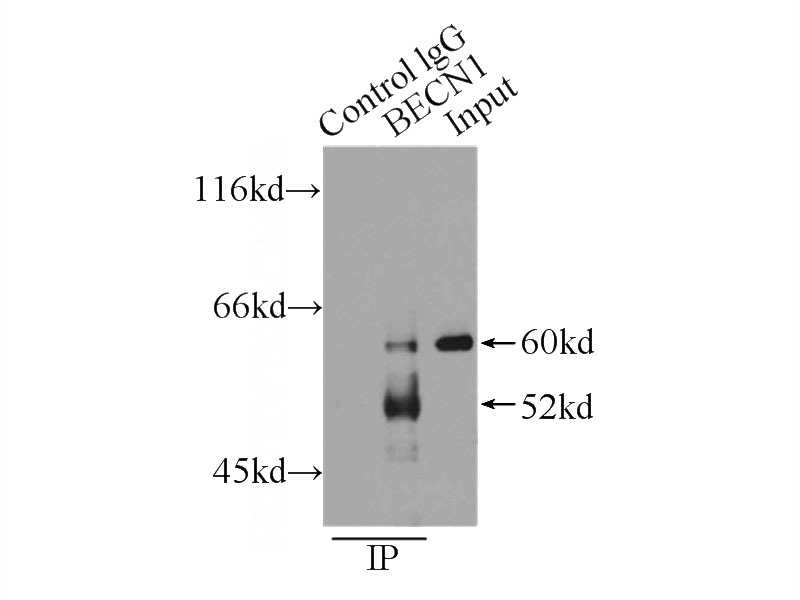 IP Result of anti-Beclin 1 (IP:Catalog No:117114, 3ug; Detection:Catalog No:117114 1:500) with HeLa cells lysate 1200ug.