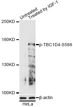 Western blot - Phospho-TBC1D4-S588 pAb 